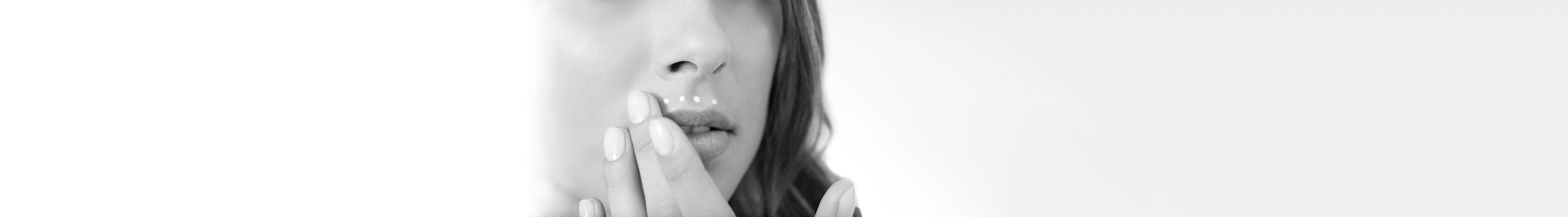 Woman´s face with melasma